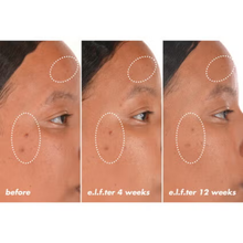 Load image into Gallery viewer, e.l.f. skin Bright Icon Vitamin C + E + Ferulic Serum