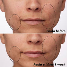 Load image into Gallery viewer, e.l.f. Skin PLZ Clarify Facial Oil