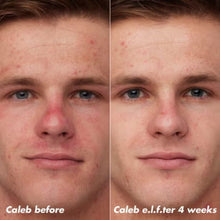 Load image into Gallery viewer, e.l.f. Skin PLZ Clarify Facial Oil
