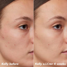 Load image into Gallery viewer, e.l.f. Skin PLZ Clarify Facial Oil
